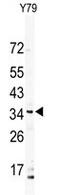 VPS26 Endosomal Protein Sorting Factor C antibody, AP13351PU-N, Origene, Western Blot image 