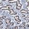 Transmembrane Protein 17 antibody, NBP1-81974, Novus Biologicals, Immunohistochemistry paraffin image 