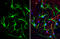 S100 Calcium Binding Protein B antibody, GTX129573, GeneTex, Immunofluorescence image 