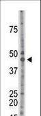 Casein Kinase 2 Alpha 1 antibody, LS-C101283, Lifespan Biosciences, Western Blot image 