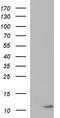CD59 Molecule (CD59 Blood Group) antibody, LS-C788569, Lifespan Biosciences, Western Blot image 