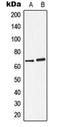 Arylsulfatase D antibody, orb216023, Biorbyt, Western Blot image 