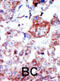 Integrin Linked Kinase antibody, abx033575, Abbexa, Immunohistochemistry paraffin image 