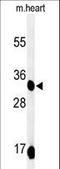 Coenzyme Q9 antibody, LS-C166952, Lifespan Biosciences, Western Blot image 