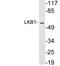 Serine/Threonine Kinase 11 antibody, LS-C199917, Lifespan Biosciences, Western Blot image 