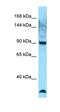 HAUS augmin-like complex subunit 1 antibody, orb326435, Biorbyt, Western Blot image 