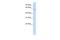 Neuropilin And Tolloid Like 2 antibody, A09555, Boster Biological Technology, Western Blot image 