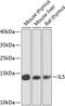 Interleukin 5 antibody, GTX55678, GeneTex, Western Blot image 