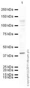 Adrenoceptor Beta 3 antibody, ab94506, Abcam, Western Blot image 