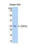 Carbonic Anhydrase 9 antibody, LS-C293146, Lifespan Biosciences, Western Blot image 