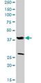 Frizzled Related Protein antibody, H00002487-D01P, Novus Biologicals, Western Blot image 