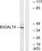 Beta-1,3-Galactosyltransferase 4 antibody, GTX87167, GeneTex, Western Blot image 