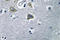 Carbonic Anhydrase 5B antibody, LS-C177357, Lifespan Biosciences, Immunohistochemistry paraffin image 