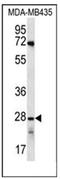 Olfactory Receptor Family 10 Subfamily AG Member 1 antibody, AP53003PU-N, Origene, Western Blot image 