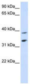 Solute Carrier Family 25 Member 34 antibody, TA334635, Origene, Western Blot image 