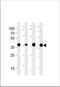 Aldolase, Fructose-Bisphosphate A antibody, TA324726, Origene, Western Blot image 