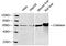 Catalase antibody, LS-C203052, Lifespan Biosciences, Western Blot image 