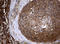 NME/NM23 Nucleoside Diphosphate Kinase 1 antibody, LS-C175592, Lifespan Biosciences, Immunohistochemistry paraffin image 