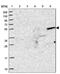 Zinc Finger Protein 627 antibody, NBP2-31893, Novus Biologicals, Western Blot image 