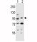 Aryl Hydrocarbon Receptor antibody, F49225-0.4ML, NSJ Bioreagents, Western Blot image 