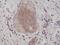 Eukaryotic Translation Initiation Factor 2 Subunit Alpha antibody, M04387, Boster Biological Technology, Immunohistochemistry frozen image 