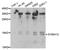 S100 Calcium Binding Protein A12 antibody, PA5-76712, Invitrogen Antibodies, Western Blot image 