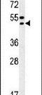 Translocation Associated Membrane Protein 2 antibody, PA5-25887, Invitrogen Antibodies, Western Blot image 