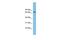 Glutamate Dehydrogenase 2 antibody, GTX45373, GeneTex, Western Blot image 