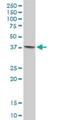 Tropomodulin 4 antibody, H00029765-B01P, Novus Biologicals, Western Blot image 