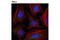 Survival Of Motor Neuron 2, Centromeric antibody, 12976S, Cell Signaling Technology, Immunocytochemistry image 