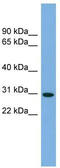 Non-Specific Cytotoxic Cell Receptor Protein 1 Homolog (Zebrafish) antibody, TA336203, Origene, Western Blot image 