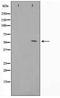 TERF1 Interacting Nuclear Factor 2 antibody, TA347584, Origene, Western Blot image 