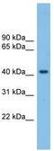 G Protein-Coupled Receptor 87 antibody, TA329468, Origene, Western Blot image 