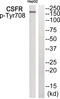 Colony Stimulating Factor 1 Receptor antibody, 79-941, ProSci, Western Blot image 