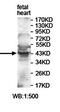 Phosphatidylinositol-5-Phosphate 4-Kinase Type 2 Alpha antibody, orb78129, Biorbyt, Western Blot image 