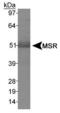 Macrophage Scavenger Receptor 1 antibody, PA5-22956, Invitrogen Antibodies, Western Blot image 