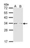 Arginase 1 antibody, LS-B4789, Lifespan Biosciences, Western Blot image 