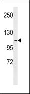 Apolipoprotein B Receptor antibody, LS-C159093, Lifespan Biosciences, Western Blot image 