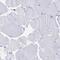 CD2 Cytoplasmic Tail Binding Protein 2 antibody, PA5-59603, Invitrogen Antibodies, Immunohistochemistry paraffin image 