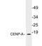 Centromere Protein A antibody, LS-C199810, Lifespan Biosciences, Western Blot image 