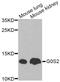 G0/G1 Switch 2 antibody, A9970, ABclonal Technology, Western Blot image 