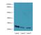 SSR-gamma antibody, MBS1493770, MyBioSource, Western Blot image 