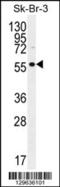 TraB Domain Containing 2A antibody, 56-020, ProSci, Western Blot image 