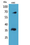 Fc Fragment Of IgG Receptor IIb antibody, STJ96611, St John