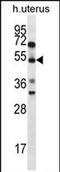 Actin Binding Rho Activating Protein antibody, PA5-71755, Invitrogen Antibodies, Western Blot image 