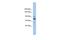 Kinesin Family Member 23 antibody, A03483, Boster Biological Technology, Western Blot image 