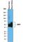 FHFR antibody, PA5-47215, Invitrogen Antibodies, Western Blot image 