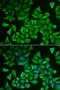Deoxythymidylate Kinase antibody, LS-C334667, Lifespan Biosciences, Immunofluorescence image 
