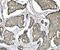 Tripartite Motif Containing 24 antibody, M03258-2, Boster Biological Technology, Immunohistochemistry paraffin image 