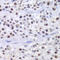 Histone Acetyltransferase 1 antibody, LS-C334546, Lifespan Biosciences, Immunohistochemistry paraffin image 